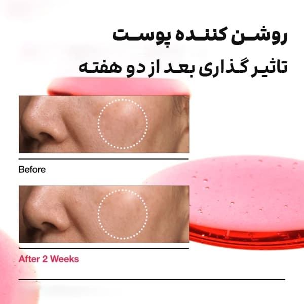 سرم ضد لک و نیاسینامید آنوا روشن کننده — تصویر ۲