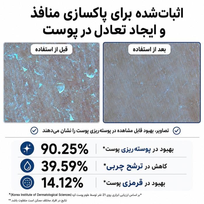 اریزر شات گلیکولیک اسید آرنسیا — تصویر ۵