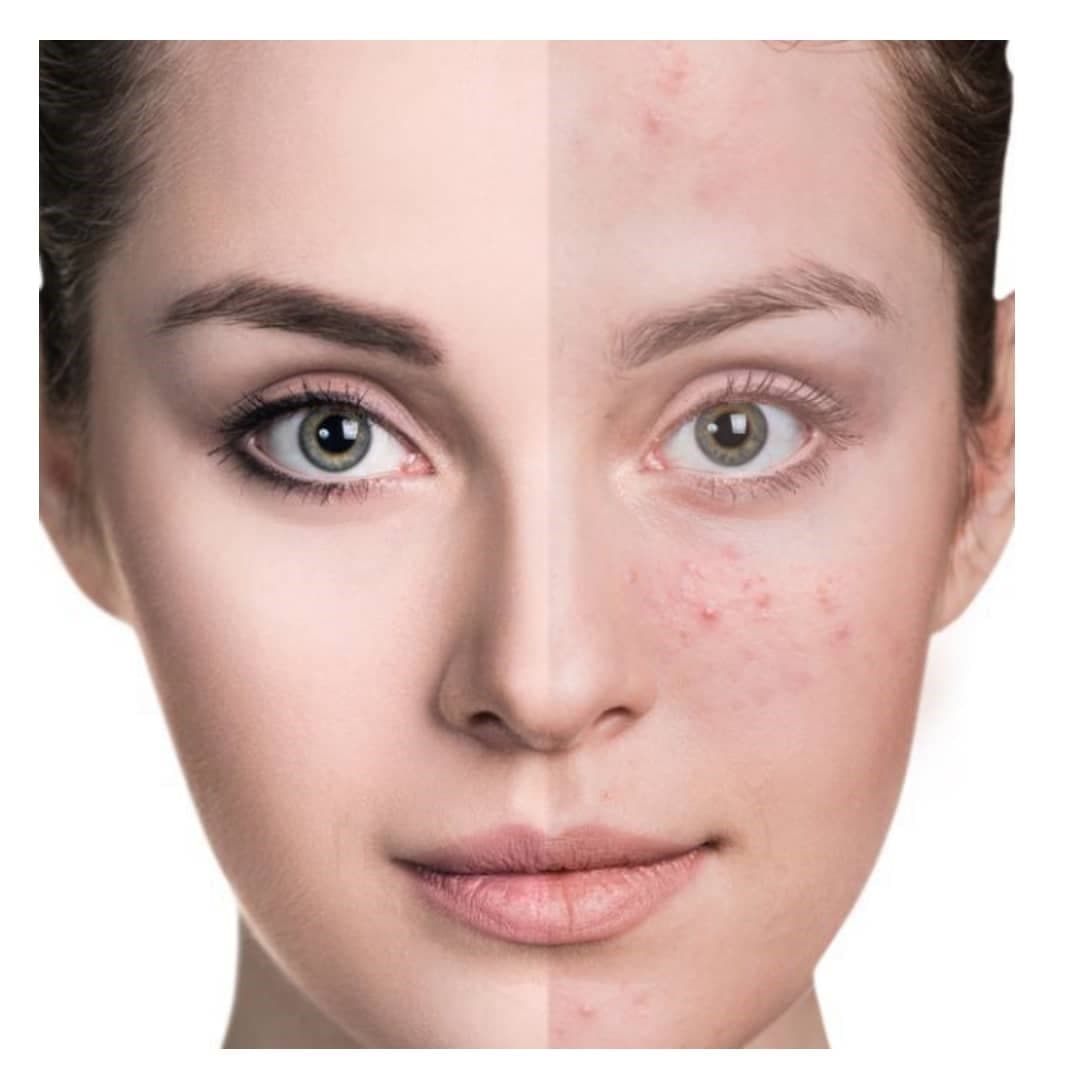 کرم ترمیم کننده سیکالیفت درمالیفت — تصویر ۲