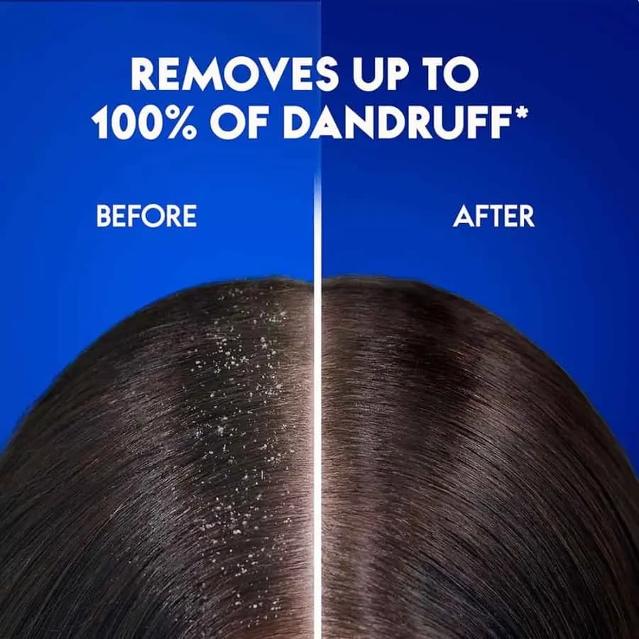 شامپو ضد شوره عصاره بادام Dry Scalp Care هد اند شولدرز 400ml — تصویر ۸