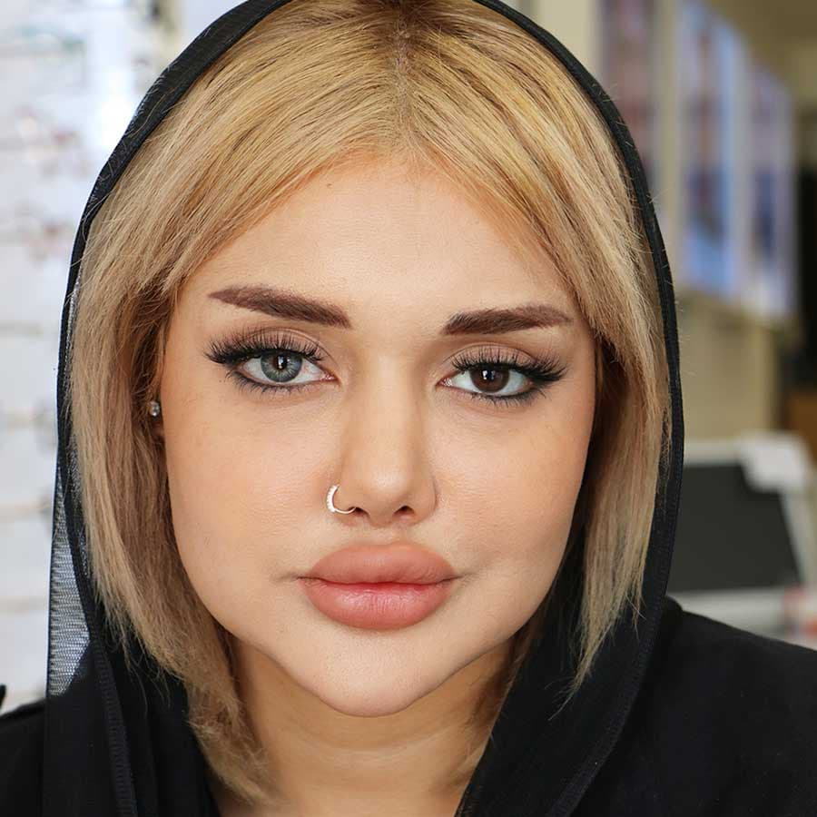 لنز رنگی ایفوریا طوسی آبی کارولینا — تصویر ۸