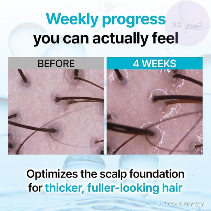 بوستر سرم تقویت کننده و محرک رشد مو گروس Growus اصل recover therapy — تصویر ۱۱