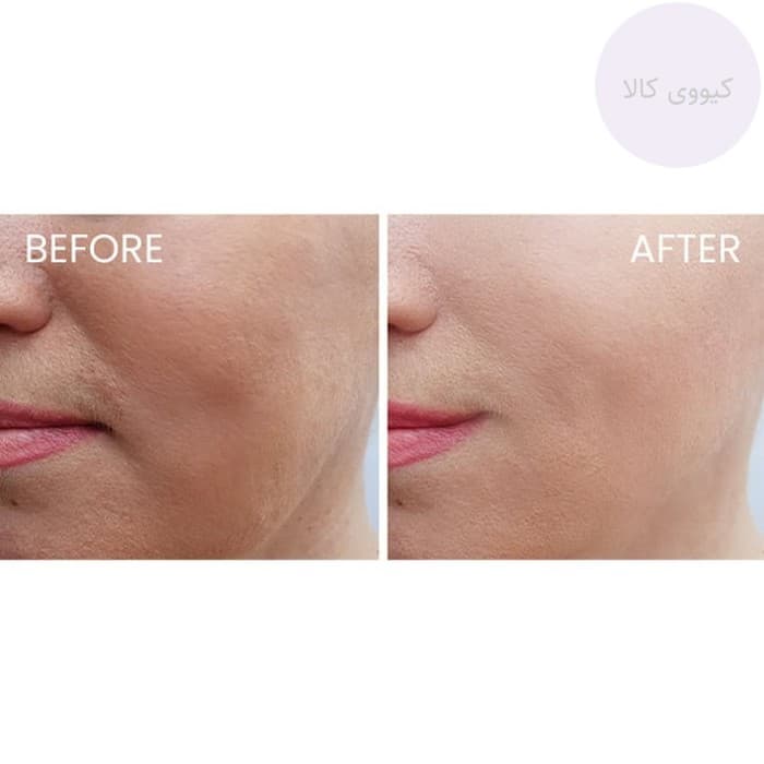 ماسک خواب هیالو سیکا سنتلا اسکین Skin 1004 آبرسان و تقویت کننده — تصویر ۱۰