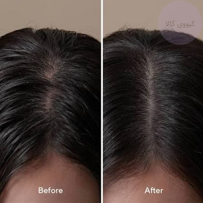 تونیک ضد ریزش مو رزماری آروماتیکا Aromatica تقویت کننده — تصویر ۳