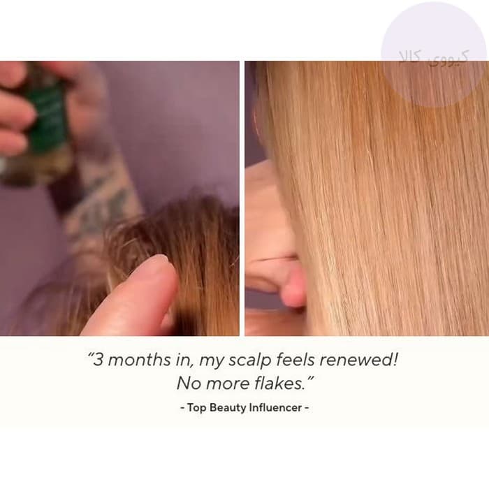 تونیک ضد ریزش مو رزماری آروماتیکا Aromatica تقویت کننده — تصویر ۷