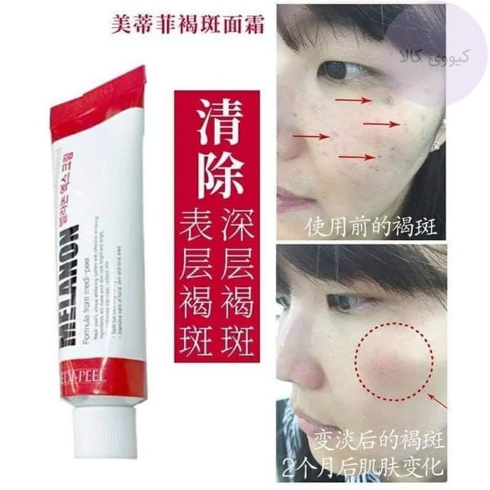 کرم ملانون ایکس melanon x مدی پیل Medi Peel ضد لک و روشن کننده — تصویر ۱۲