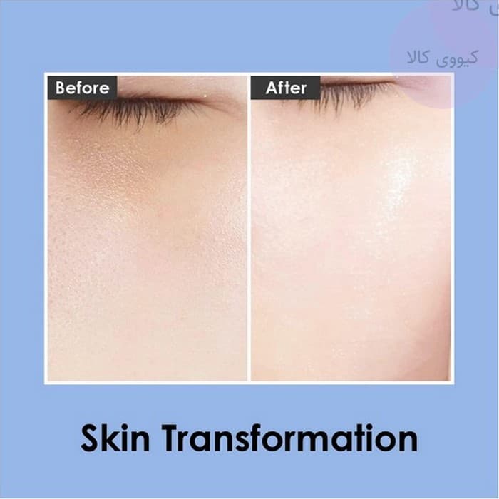 کرم دور چشم eye tox مدی پیل Medi Peel ضد چروک و ضد پیری — تصویر ۸