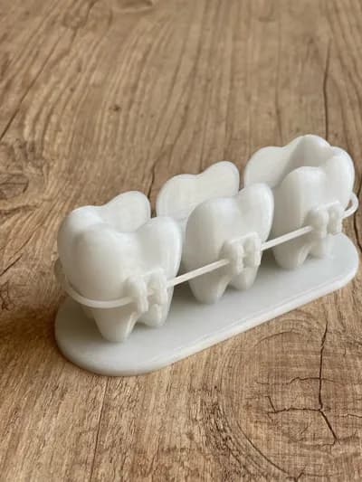 جاکارتی ارتودنسی با کیفیت بالا – خدمات چاپ سه‌بعدی — تصویر ۴