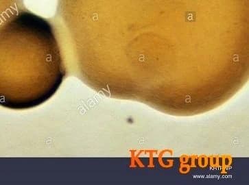 محیط کشت GC آگار | هلدینگ KTG