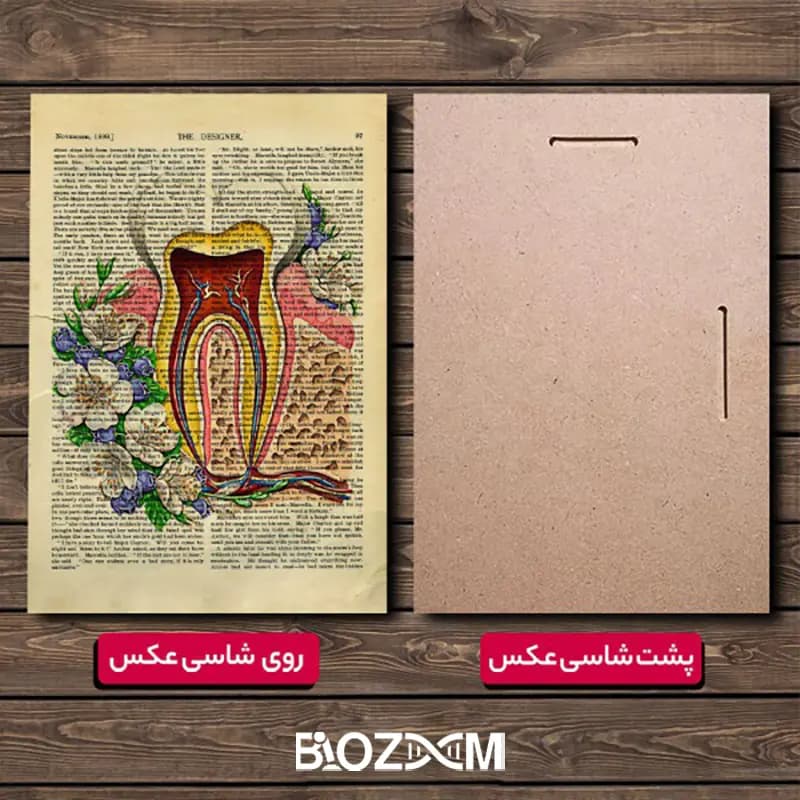 شاسی عکس طرح دندان 2 – کد 116 — تصویر ۸