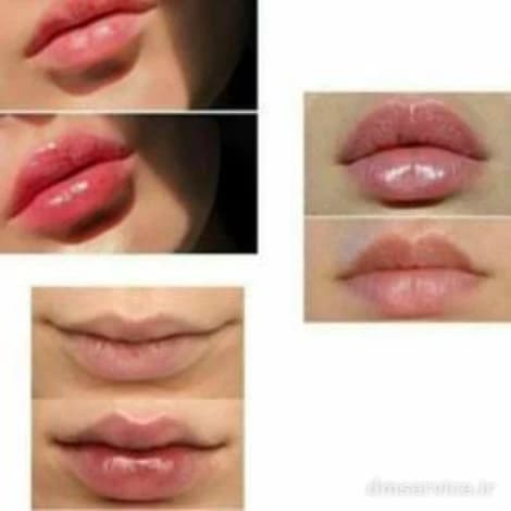 حجم دهنده لب آمپولی کیس بیوتی | خرید Lip Plumper Kiss Beauty — تصویر ۳