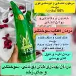 ژل آلوئه ورا شاخکی | خرید ژل آبرسان و تسکین دهنده آلوئه ورا — تصویر ۳