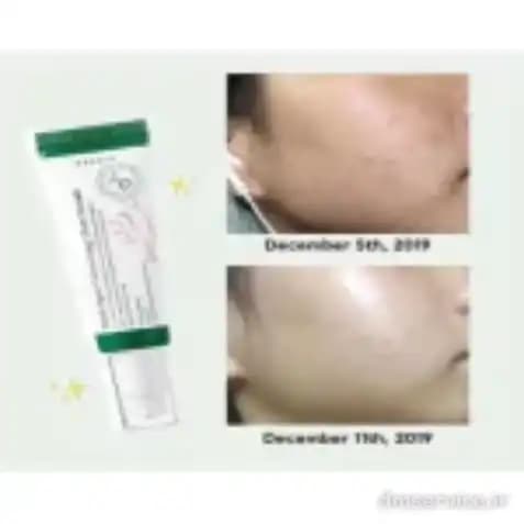 سرم ضد لک اکسیس وای |Axis-Y Dark Spot Correcting Glow Serum — تصویر ۴