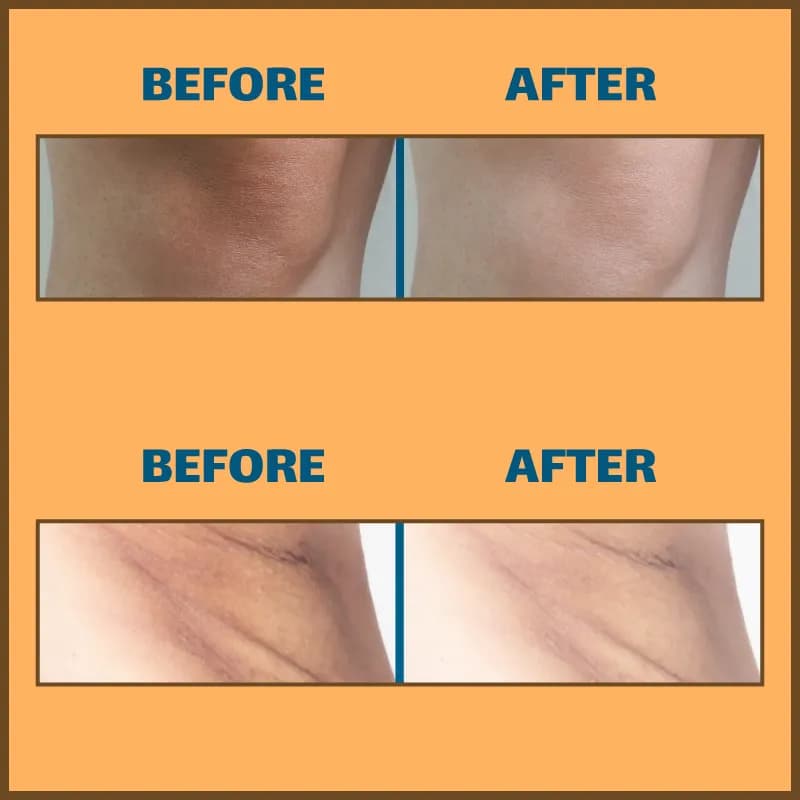 اسپری پیل شات کوجیک اسید دکتر ملاکسین لایه بردار و روشن کننده پوست — تصویر ۶