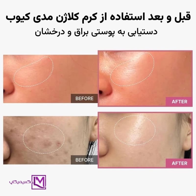 کرم کلاژن آبرسان ژله ای اورجینال — تصویر ۲