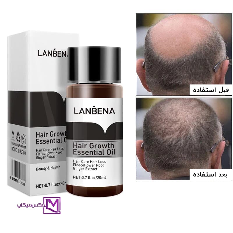 سرم تقویت کننده و رشد مو مدل essence growth