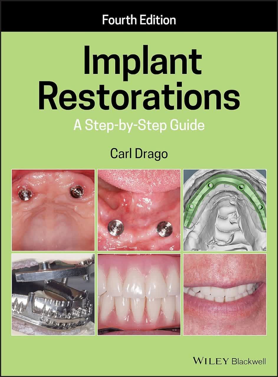 Implant Restorations: A Step-by-Step Guide – راهنمای گام به گام ترمیم ایمپلنت ویرایش چهارم — تصویر ۲