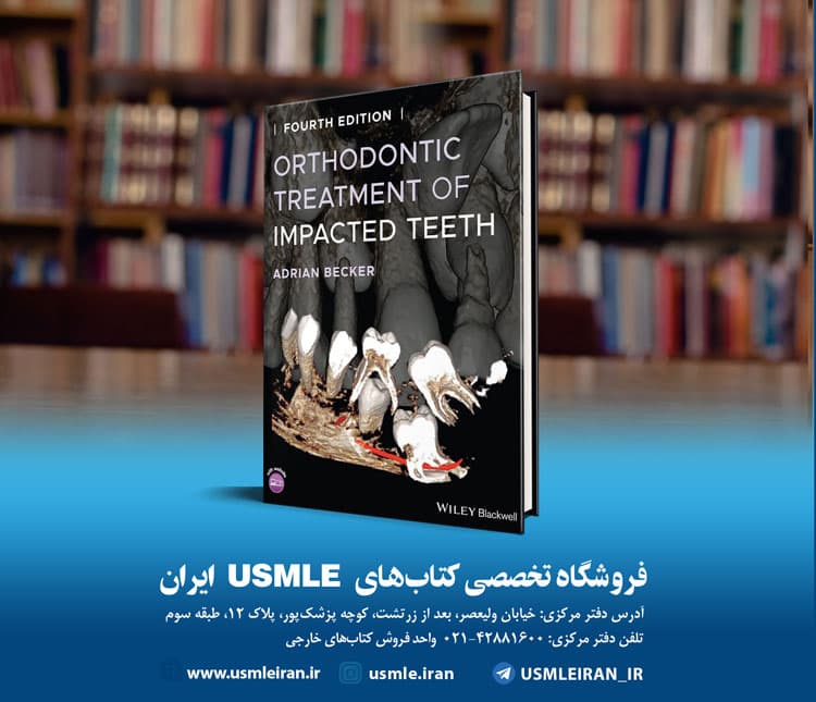 Orthodontic Treatment of Impacted Teeth