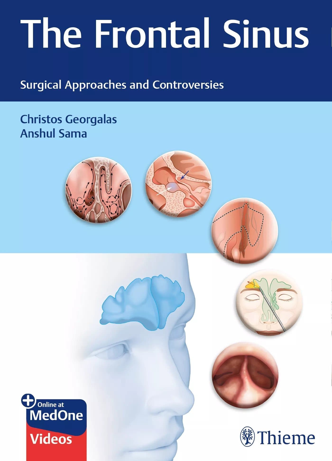 The Frontal Sinus: Surgical Approaches and Controversies (کیفیت چاپ سوپرپیکسل) — تصویر ۲