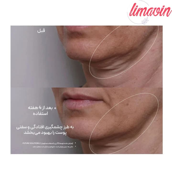 سرم ضد چروک و سفت کننده قوی سولوشن ال ایکس شیسیدو حجم 50 میلی لیتر — تصویر ۲