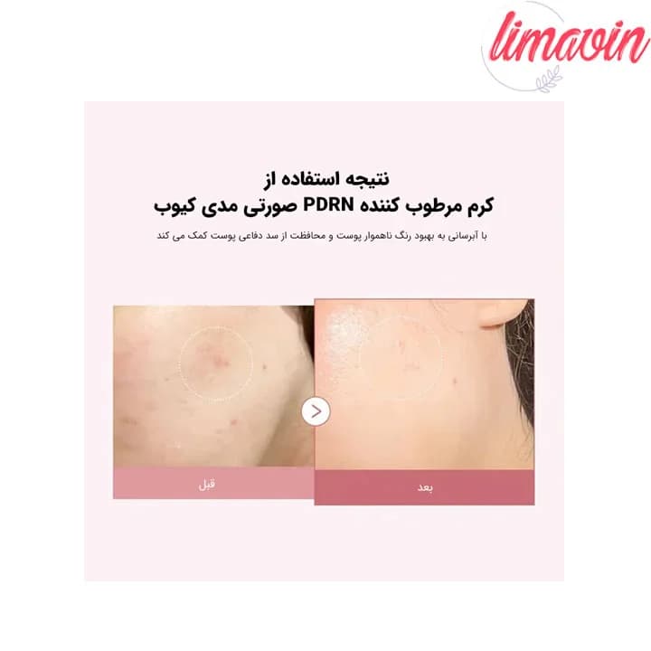 کرم مرطوب کننده هیالورونیک و PDRN مدی کیوب حجم 50 میلی لیتر — تصویر ۲