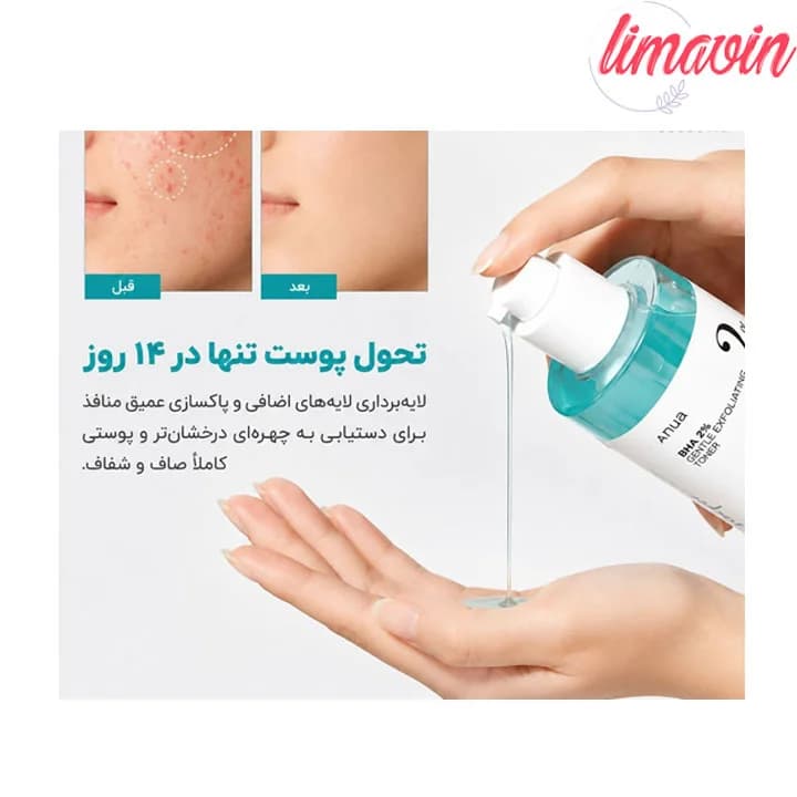 تونر لایه بردار و کنترل منافذ آنوا حجم 150 میلی لیتر — تصویر ۲