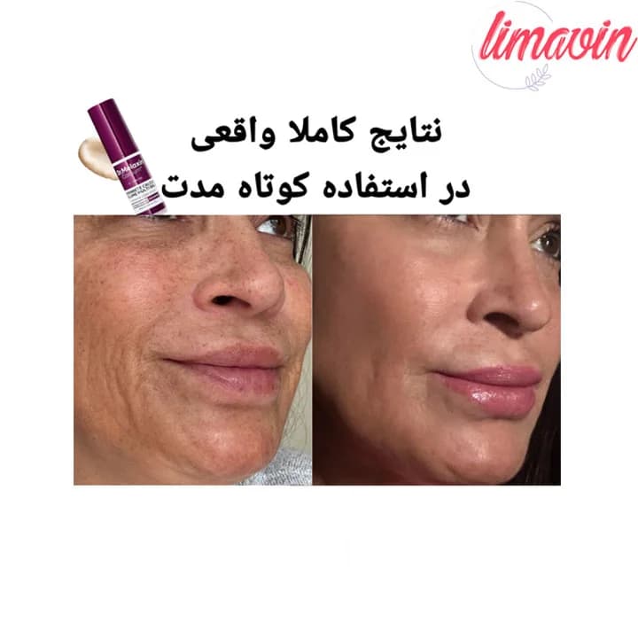مولتی بالم دور چشم دکتر ملاکسین ضد چروک قوی حجم 9 گرم — تصویر ۸