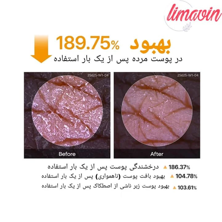 اسپری پیل شات کوجیک اسید دکتر ملاکسین لایه بردار و روشن کننده بدن حجم 200 میلی لیتر — تصویر ۱۰