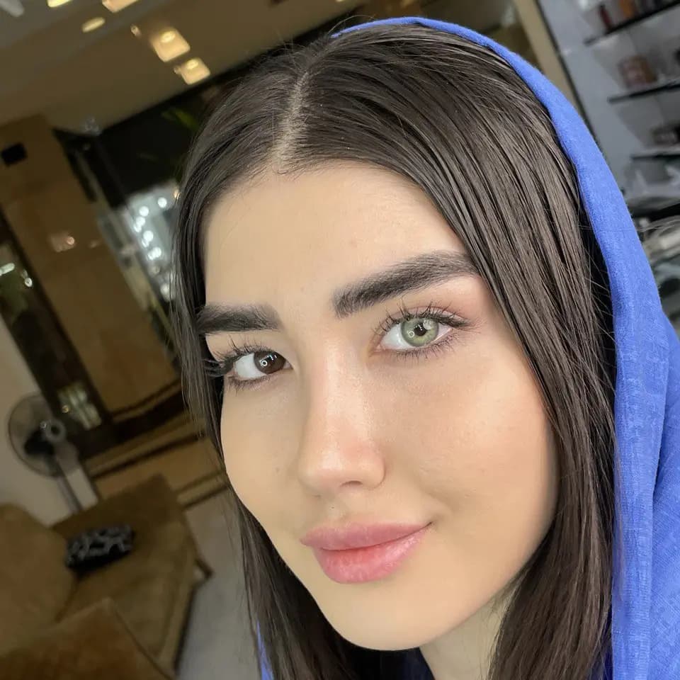 لنز مارلی شاینی گرین سبز رگه دار دور دار | Marley Shiny Gray Lens — تصویر ۳