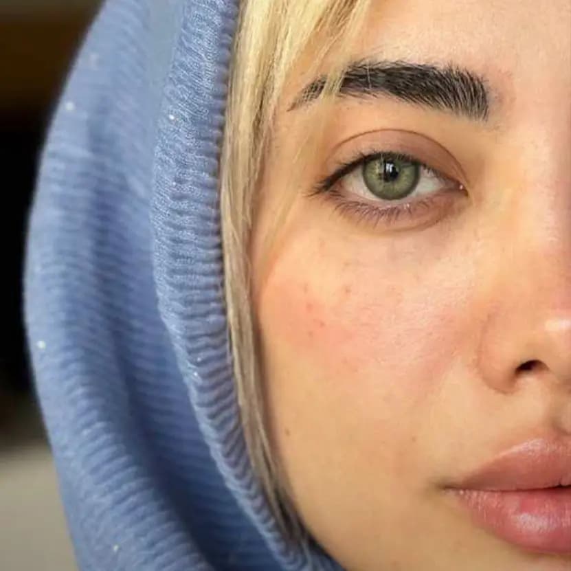 لنز مارلی شاینی گرین سبز رگه دار دور دار | Marley Shiny Green Lens — تصویر ۲