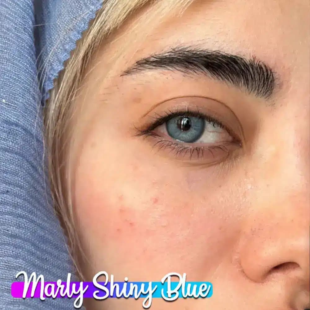 لنز مارلی شاینی بلو آبی رگه دار دور دار | Marley Light Blue lens — تصویر ۱۰