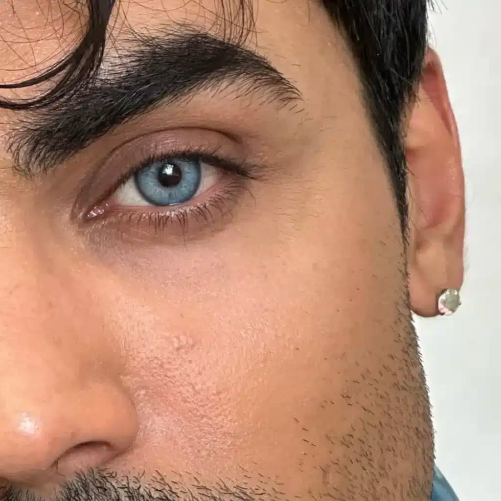 لنز مارلی شاینی بلو آبی رگه دار دور دار | Marley Light Blue lens — تصویر ۹