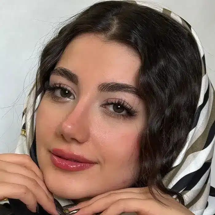 لنز مارلی آنجل گرین سبز تیره دور محو | marley-angel-green-lens — تصویر ۶