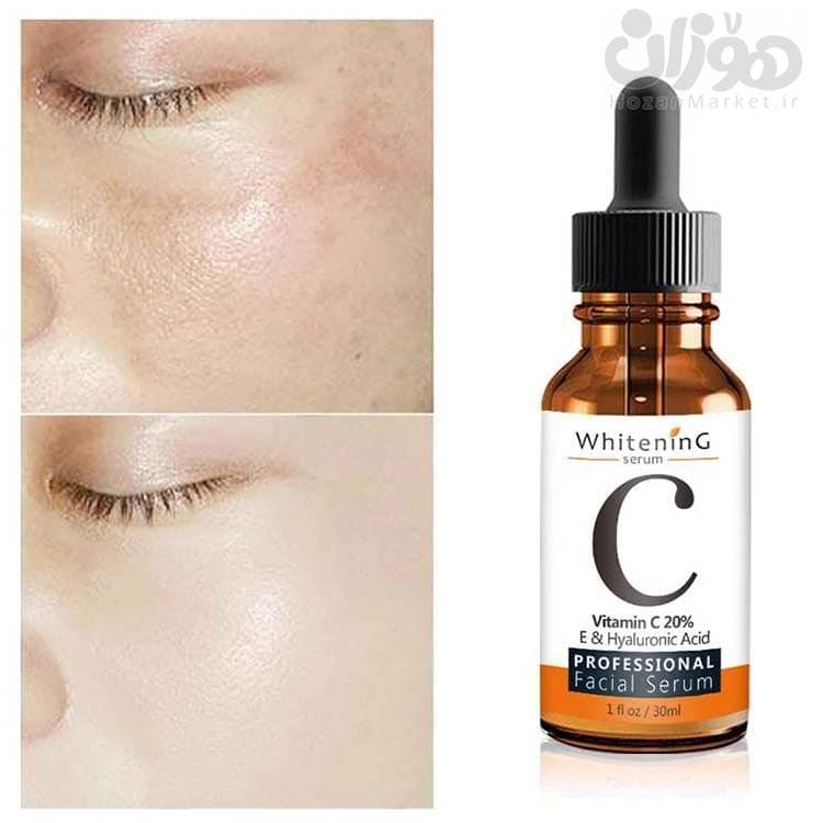 سرم ویتامین سی مویام Mooyam Serum — تصویر ۱۰