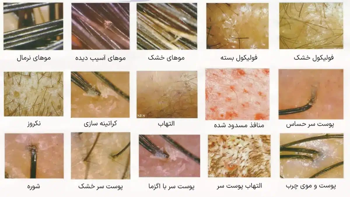 اسکالپ مو 5 هندپیس — تصویر ۷