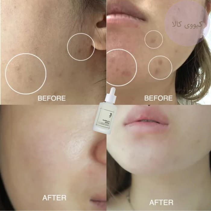 سرم نرم کننده شماره 3 نامبوزین Numbuzin مدل skin softening — تصویر ۱۰