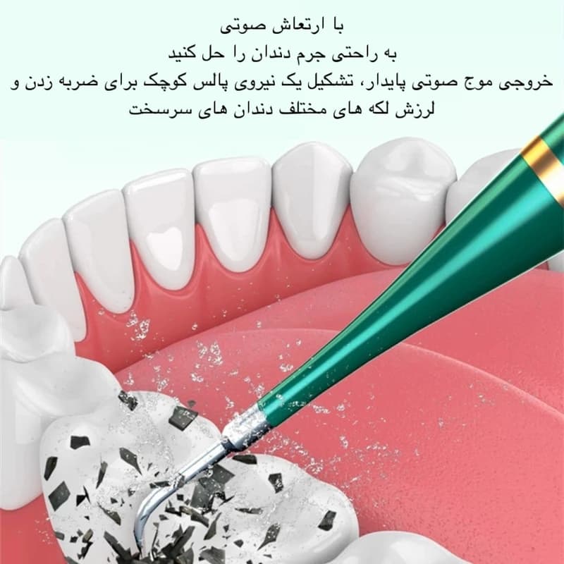 جرم گیر خانگی و مسواک برقی مدل LC-H228 سفید صدفی — تصویر ۱۲