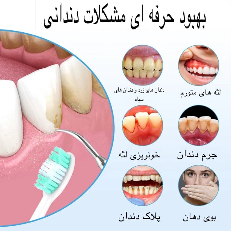 جرم گیر خانگی و مسواک برقی مدل LC-H228 سفید صدفی — تصویر ۶