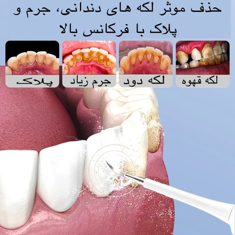 جرم گیر خانگی و مسواک برقی مدل LC-H228 سفید صدفی — تصویر ۵