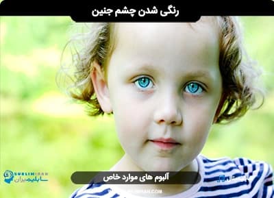 چشم رنگی شدن جنین