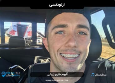 ارتودنسی — تصویر ۲