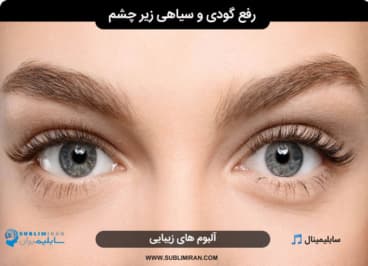 رفع گودی و سیاهی زیر چشم