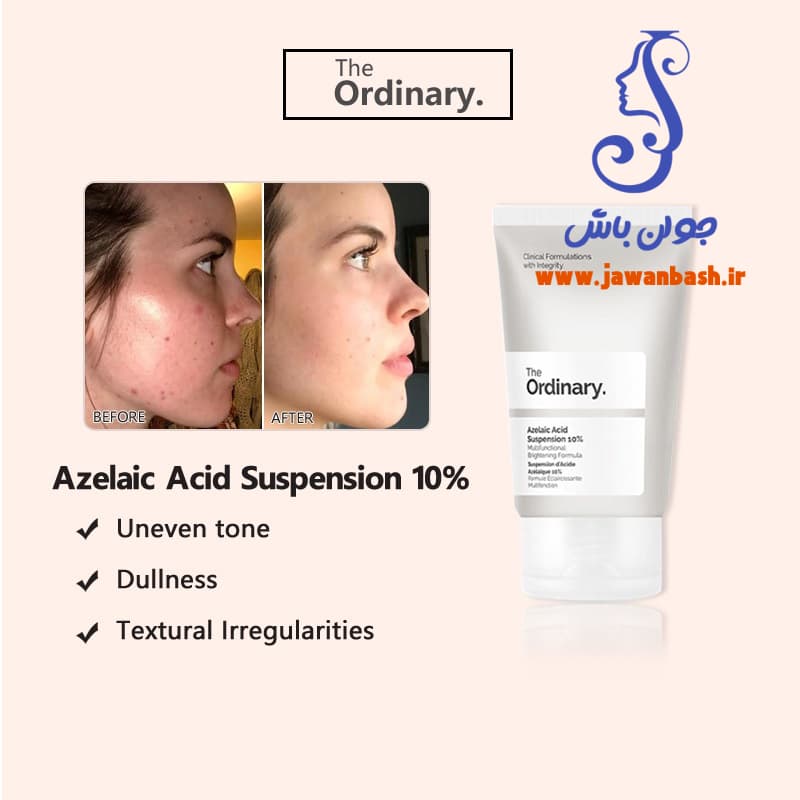 کرم آزلائيک اسید اوردینری 10% (30mL) — تصویر ۵
