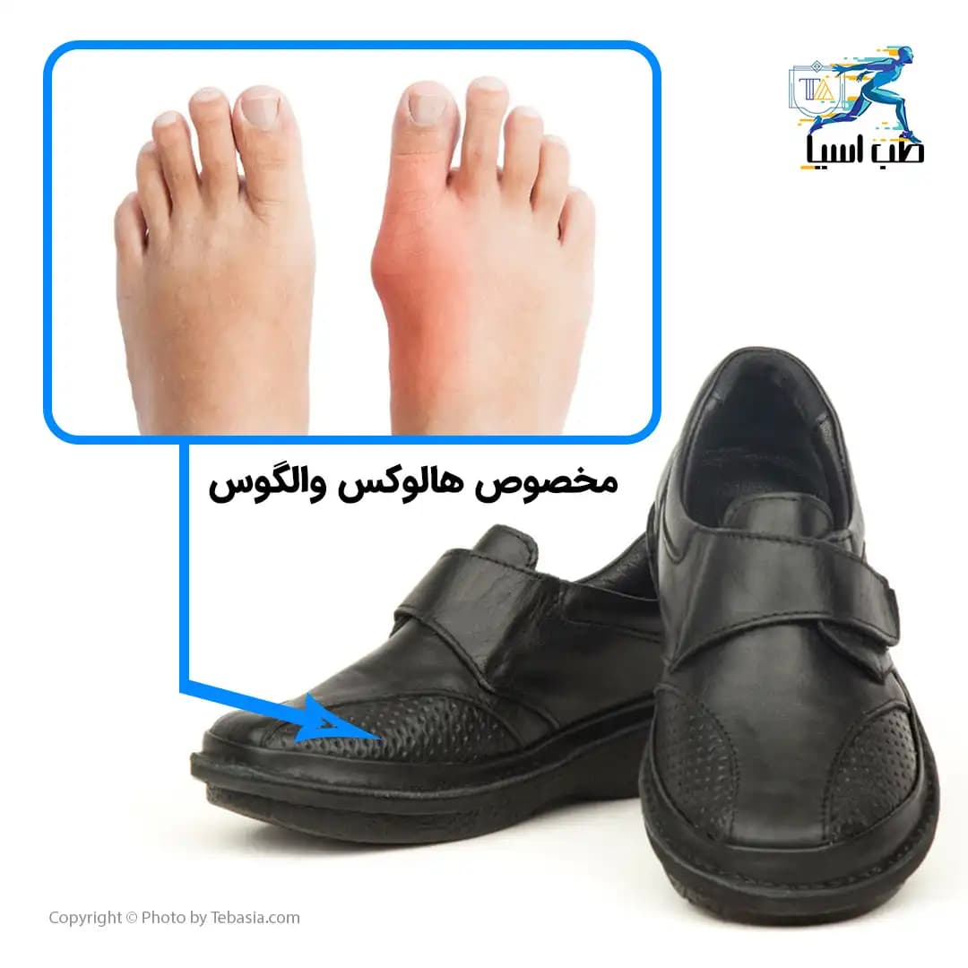 کفش زنانه آسیاسنتر مدل هالوکس والگوس — تصویر ۲