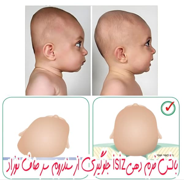 بالش فرم دهی سر نوزاد ایسیز (isiz) — تصویر ۴