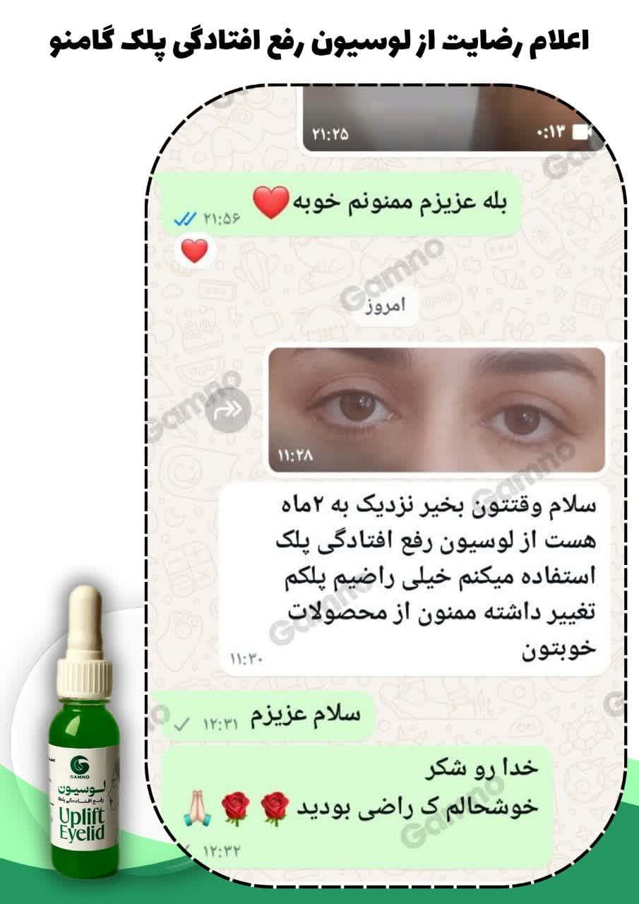 لوسیون رفع افتادگی پلک گامنو — تصویر ۳