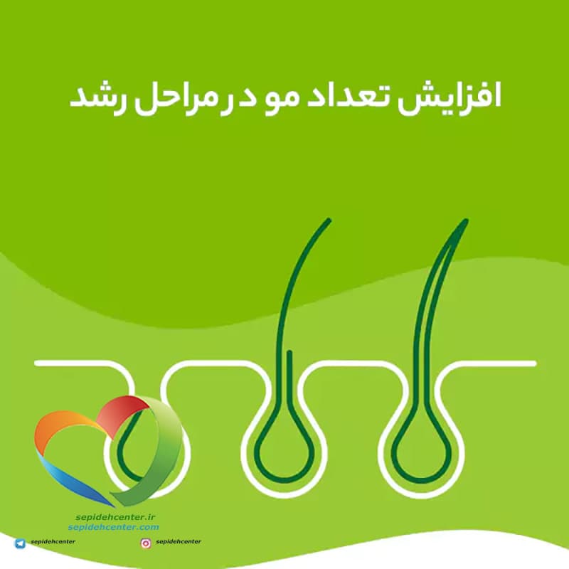 تقویت کننده مو پریورین برند بایر آلمانی اصل (Priorin Kapseln) حاوی 120عدد — تصویر ۴