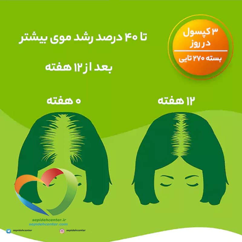 تقویت کننده مو پریورین برند بایر آلمانی اصل (Priorin Kapseln) حاوی 120عدد — تصویر ۵