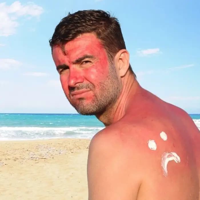 اسپری ضدآفتاب SPF 50 پوست حساس باباریا 200 میل — تصویر ۵