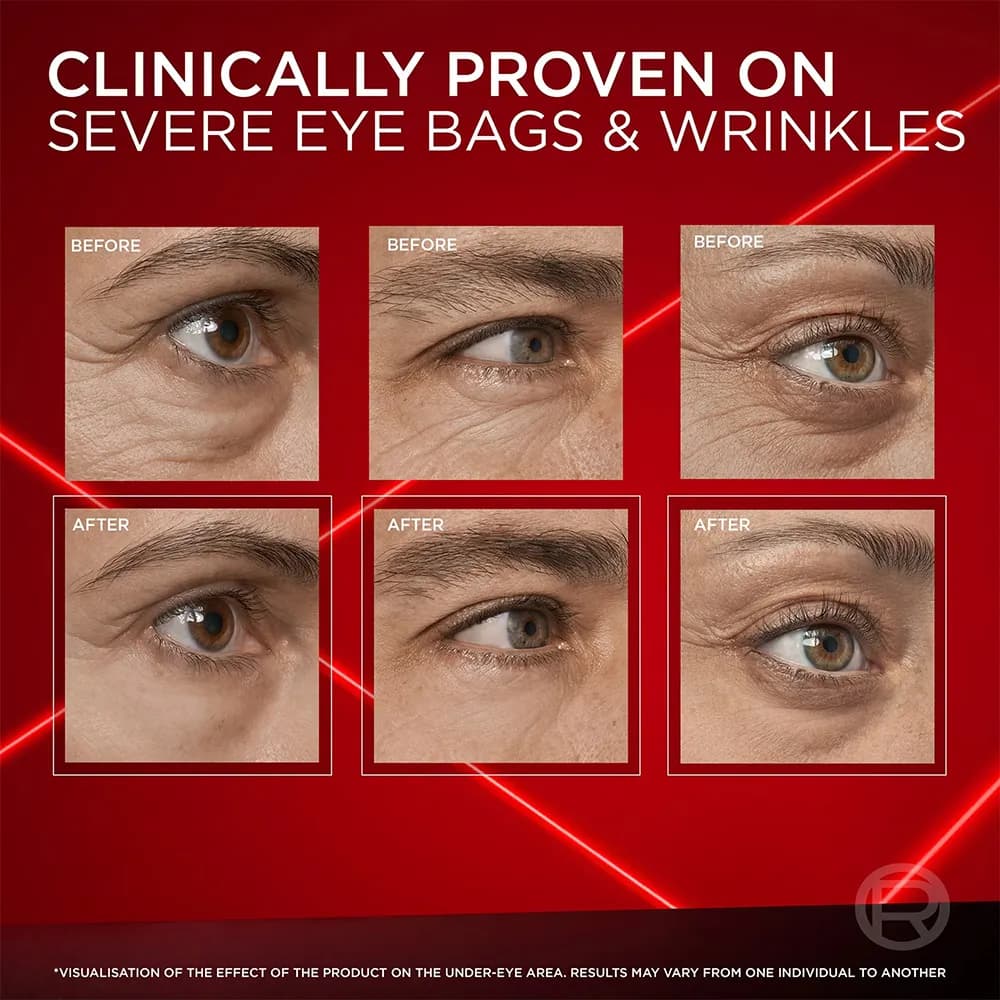 کرم دور چشم ضد پف فوری رویتالیفت لیزر لورال Revitalift Laser Eye Bag Instant Eraser اورجینال — تصویر ۲